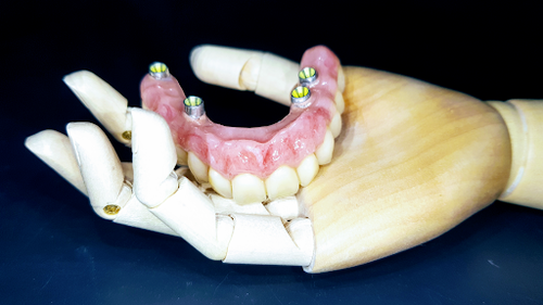 La Nuova Odontotecnica