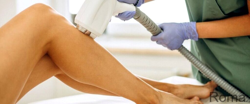 I 4 migliori servizi di depilazione laser a Roma